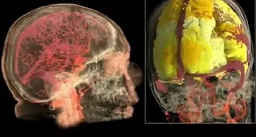 First MRI scan video of female orgasm shows how activity lights up