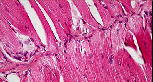 Patients Regrow Muscles with Pig Bladder Tissue | Awaken