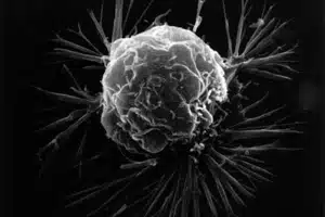 breast-cancer-cell-awaken