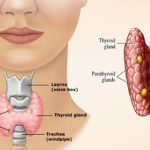 thyroid-awaken