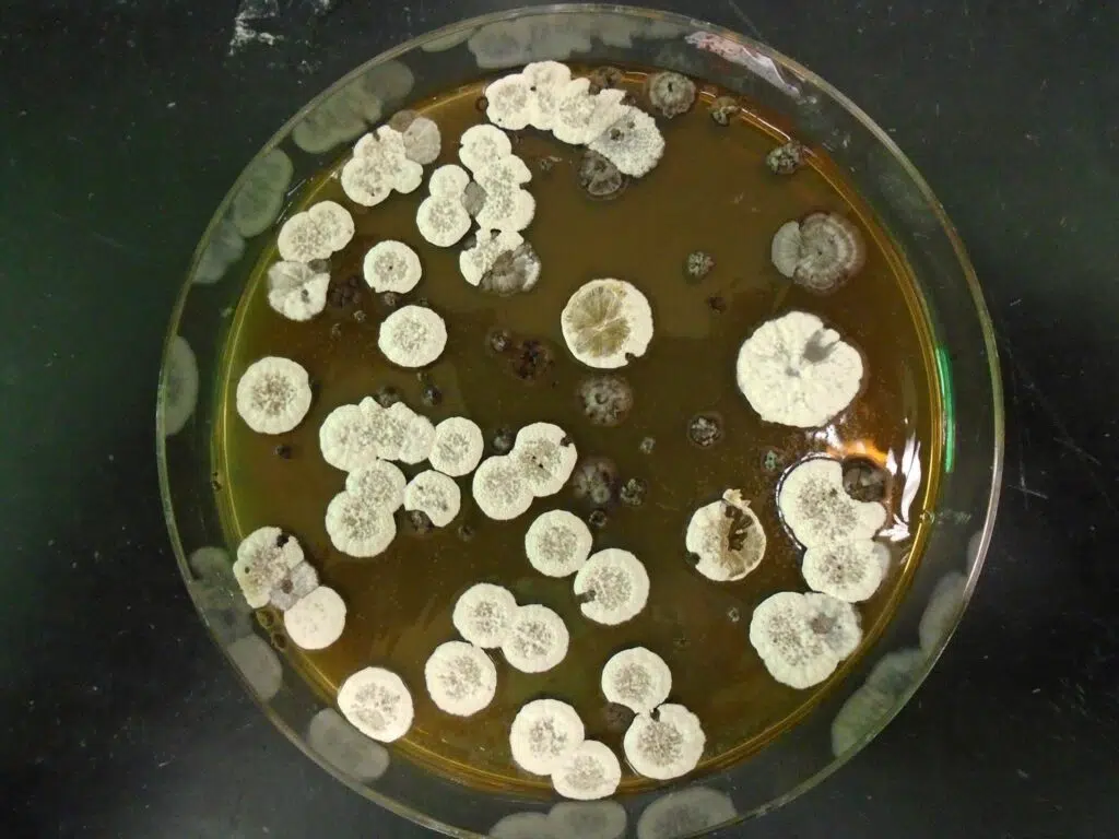 Common-Bacteria-Streptomyces-awaken